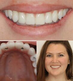 4M Dental Implant Center