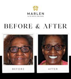 Marlen Elite Dental Wellness