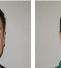 Weight loss Valley medical