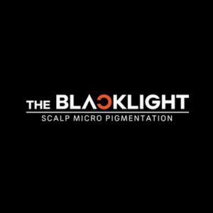 THE BLACK LIGHT — Scalp Micropigmentation (SMP)