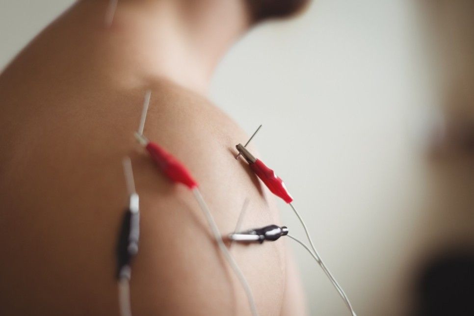 Floreat Acupuncture