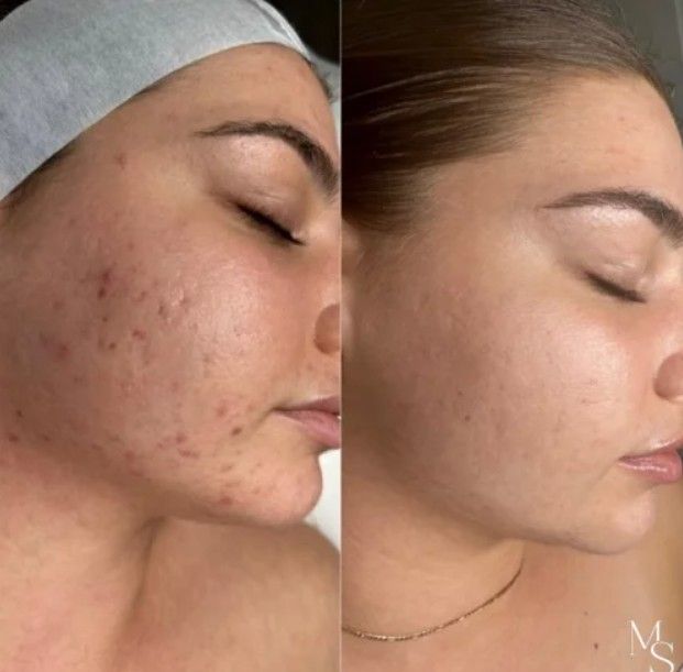Melbourne Skin
