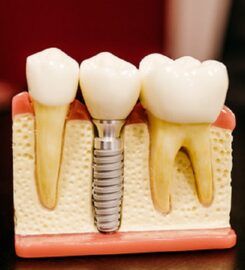 Alpha Dental Group