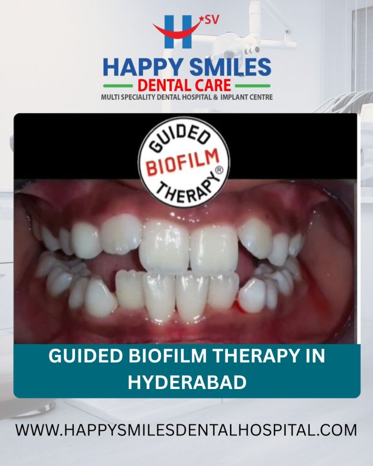 Affordable Guided Biofilm Therapy Cost in Hyderabad – Modern De &hellip;