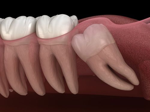 Ilchester Dental & Implant Centre