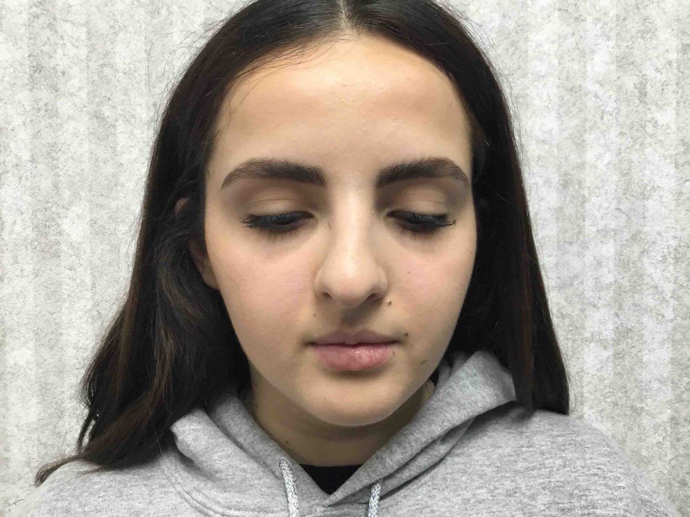 Bazzi Plastic Surgery