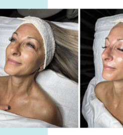 Chicago Facial