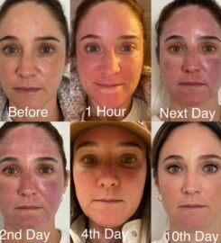 Skin + Face Phoenix