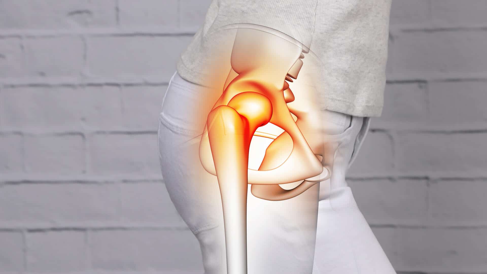 Dr. Vijay C. Bose Hip Resurfacing Surgeon in India