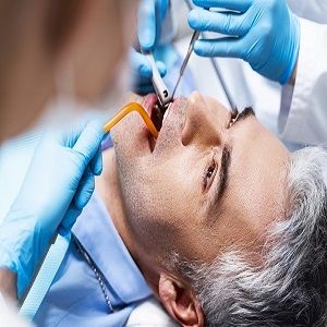 Root Canal Treatment Specialist London