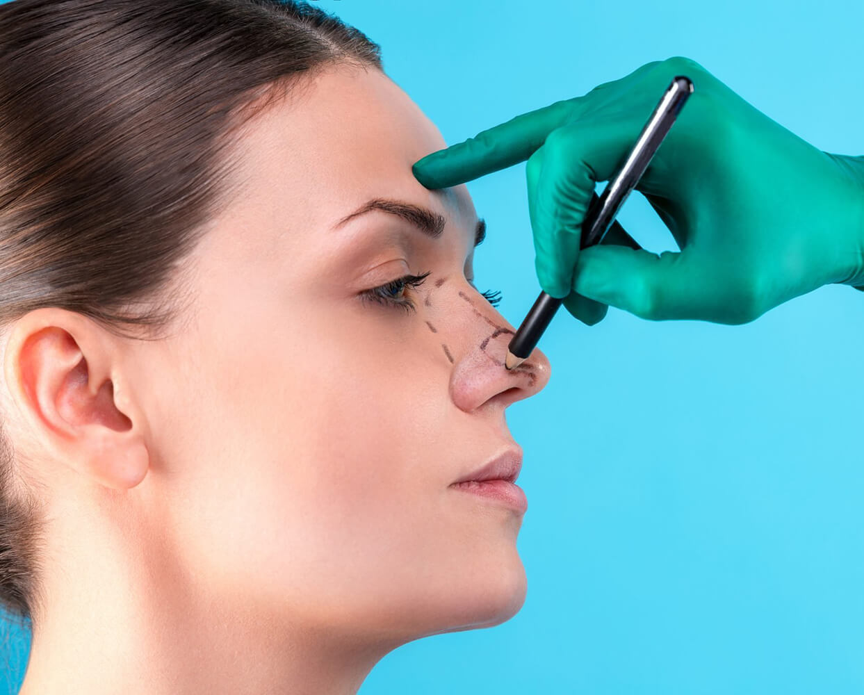 Cosmeticoplasty