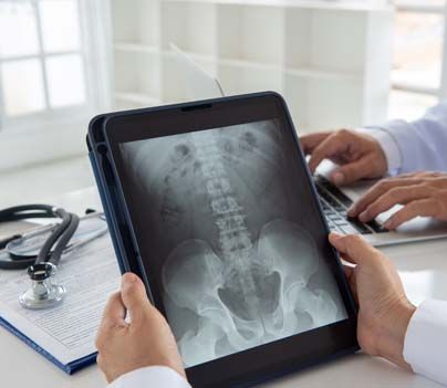 Best Price for Spine Surgery India