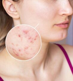 Derma Station The Skin Clinic – Dermatologist in Delhi