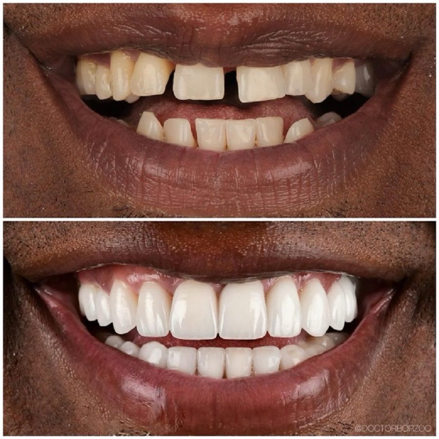 Dr. Borzoo Ahmadi DDS – Cosmetic Dentist