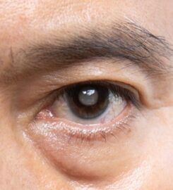 Asia Retina Eye Surgery Centre