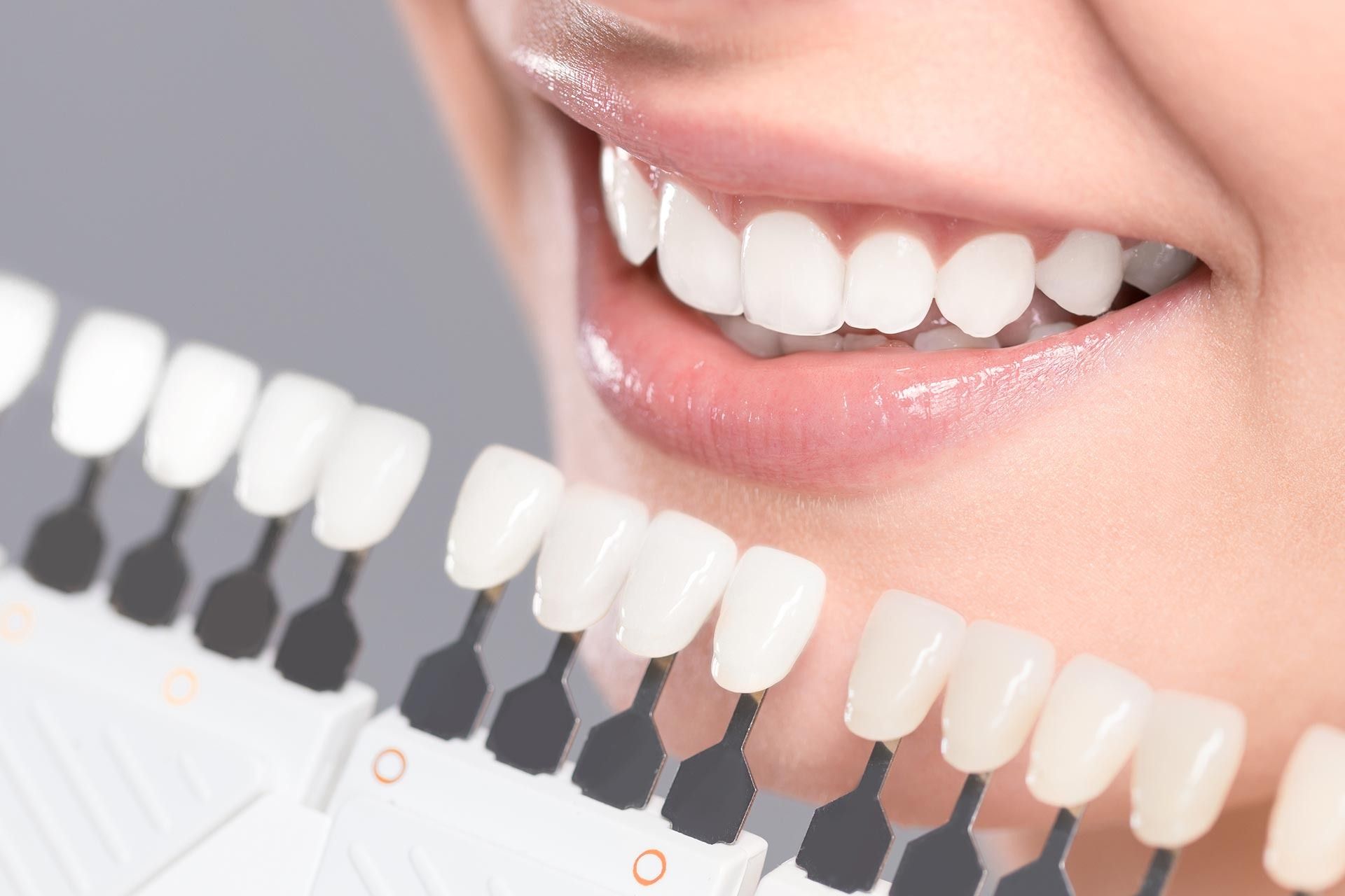Dentxperts Clinic
