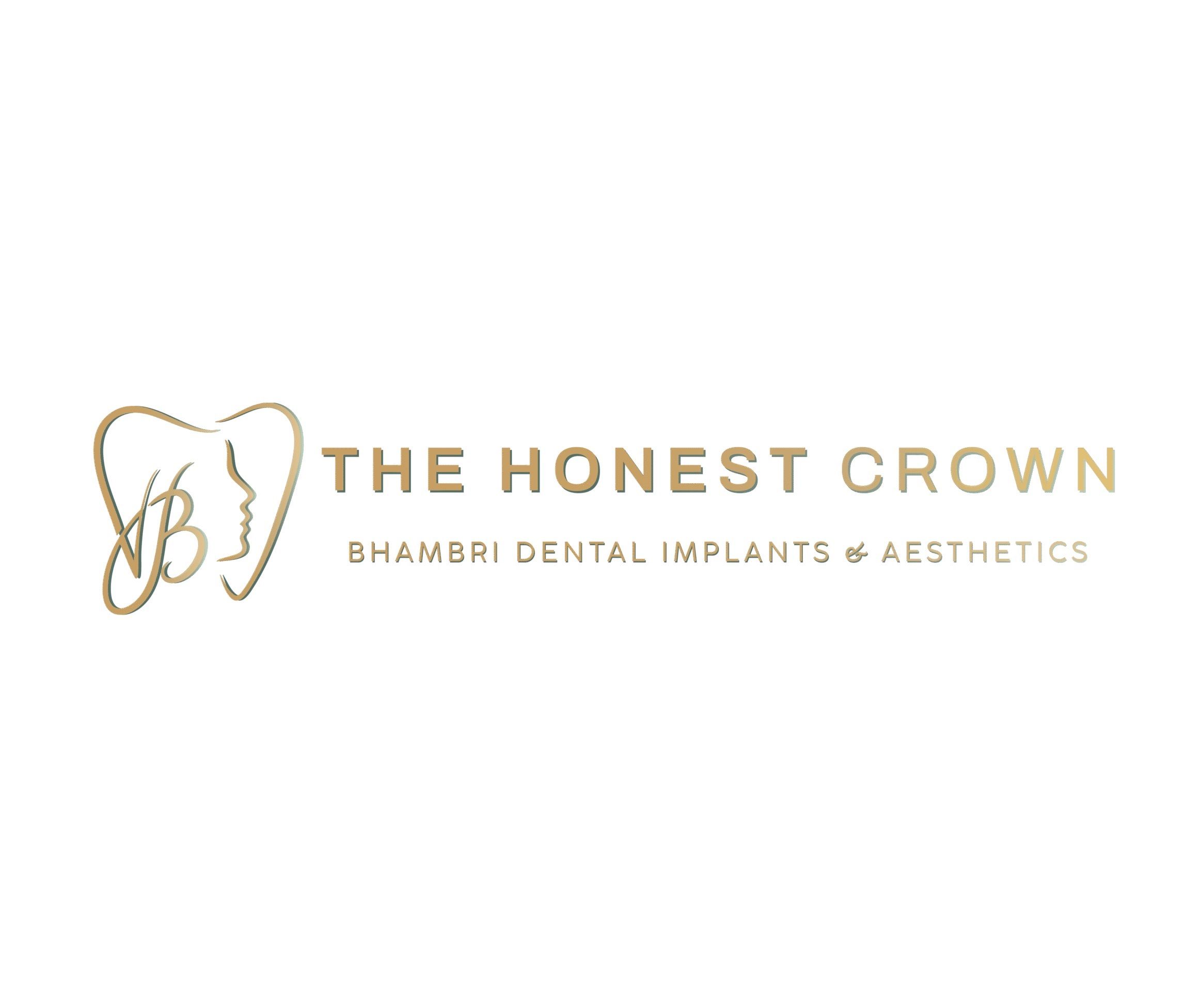 Dentist Livingston | The Honest Crown | Bhambri Dental Implants