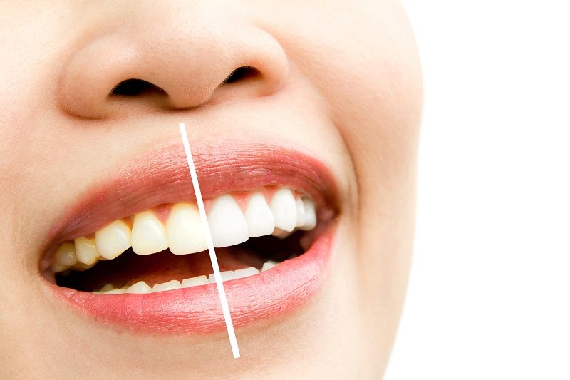 American Dental Clinic