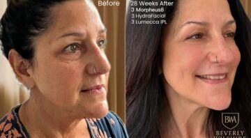 Beverly Wilshire Aesthetics Beverly Hills Medical Spa