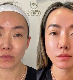Beverly Wilshire Aesthetics Beverly Hills Medical Spa