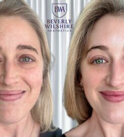 Beverly Wilshire Aesthetics Beverly Hills Medical Spa
