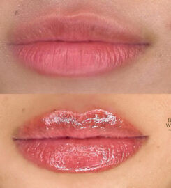 Beverly Wilshire Aesthetics Beverly Hills Medical Spa