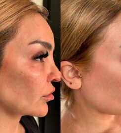 Beverly Wilshire Aesthetics Beverly Hills Medical Spa
