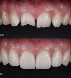 ID Dental and Implant Center