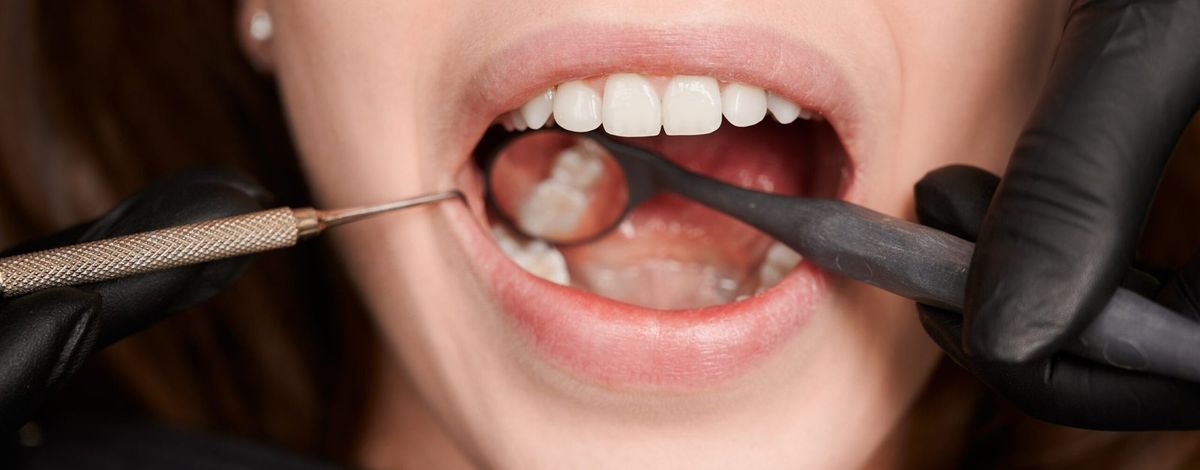 Macro photography of a beautiful female smile with white healthy teeth Close-up, cropped snapshot of good looking woman at dentist office during teeth checkup. Dentist examining patient's teeth with mirror and explorer. Oral hygiene concept
