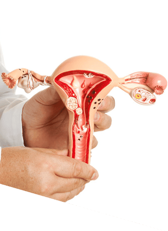 women uterus image