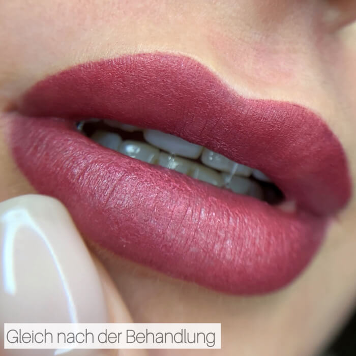 Lippen Pigmentierung - Gleich nach der Behandlung.