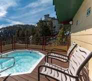 Khác 7 Holiday Inn Club Vacations TAHOE RIDGE RESORT, an IHG Hotel