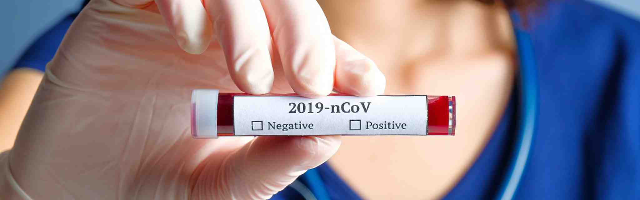 Covid 19 Tests Which One Should I Take