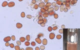 Micrograph of particles from a sample of red rain