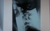 Radiograph of the larynx, a broken poltergeist
Translated by «Yandex.Translator»