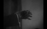 Mr. Hyde's hairy hand