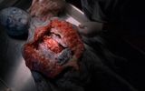 Autopsy of the alien body (presumably fake)