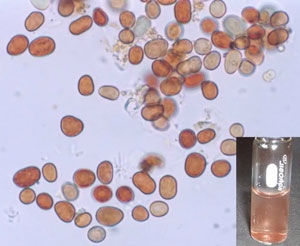 Micrografía de partículas de una muestra de lluvia roja