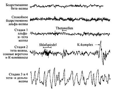 Diez segundos de cinco típicos de eeg de los diferentes estados de sueño y vigilia.
Traducido del servicio de «Yandex.Traductor»