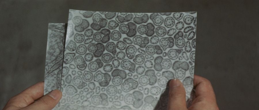 Frankenstein cells under the microscope