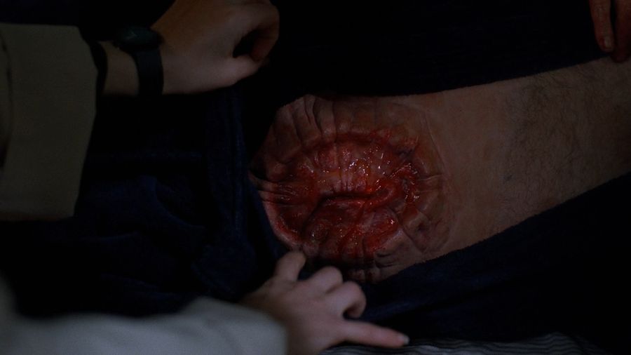 The wound on the body of lenny in the place where Leonard was
Translated by «Yandex.Translator»