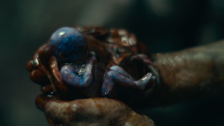 Zombie Embryo