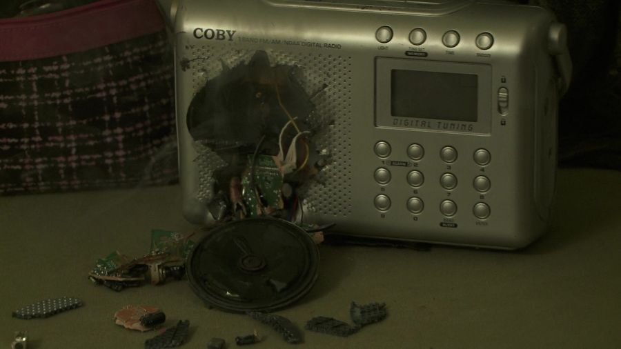 Radio explotada al intentar extraer el implante