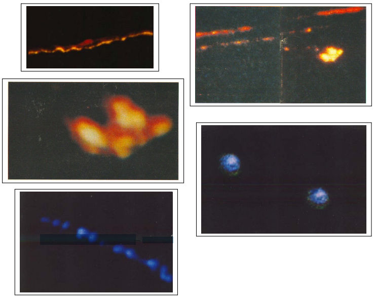 Examples of photos taken from November 12, 1981 to December 1, 1981 with an unknown light phenomena
Translated by «Yandex.Translator»