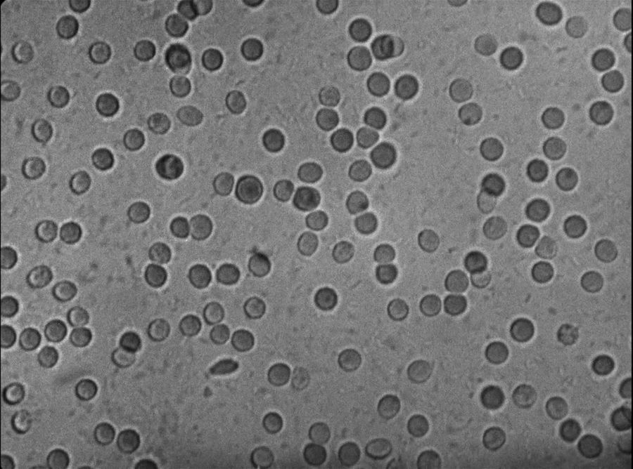 Sangre de monstruo bajo el microscopio