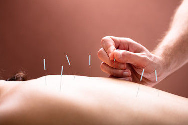 Acupuncture For Pain