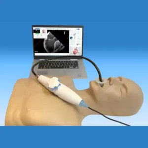 ecocardiograma transesofágico
