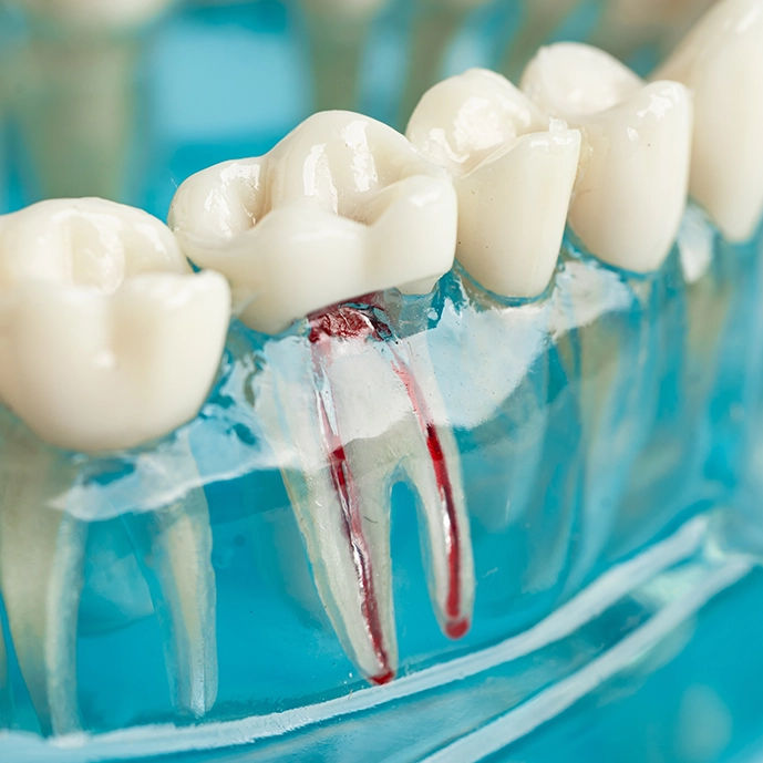 woman with root canal pain