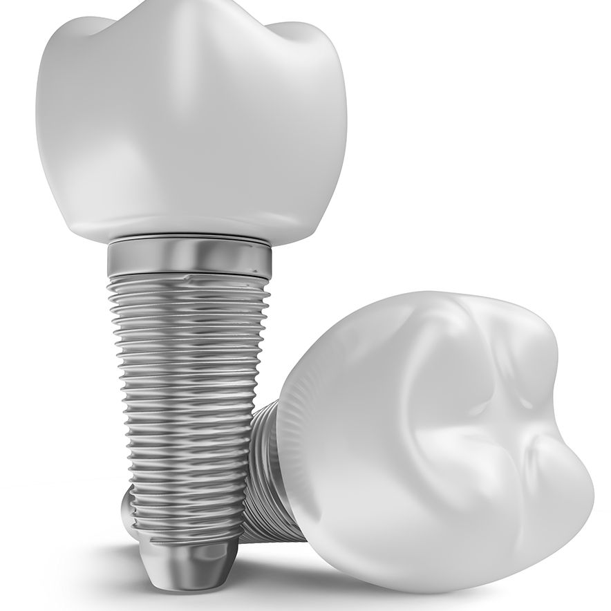 single tooth implant