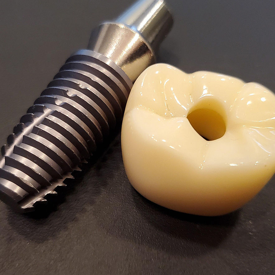 snap-in implant dentures